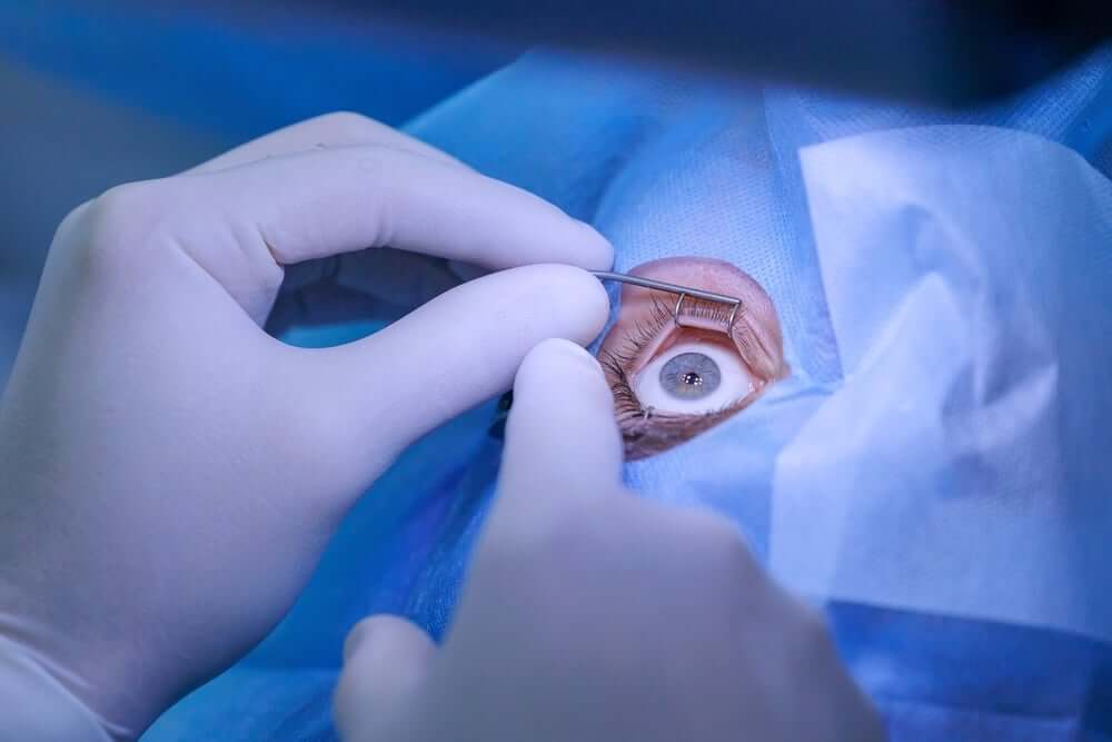 Lasik Consultations Maple Grove