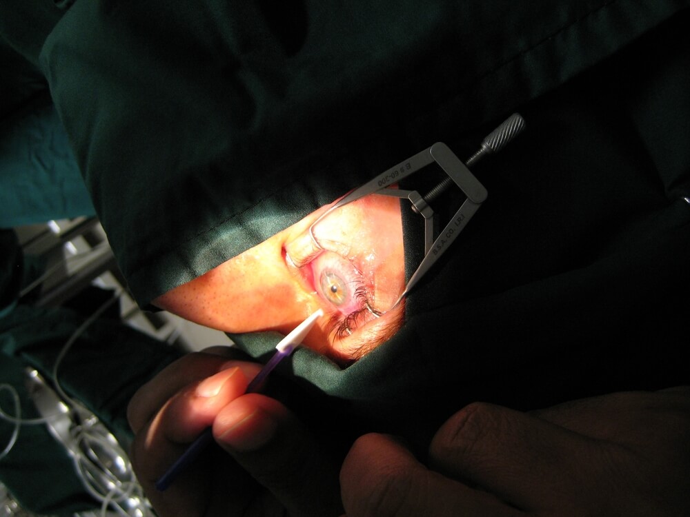 Corneal Refractive Therapy Champlin