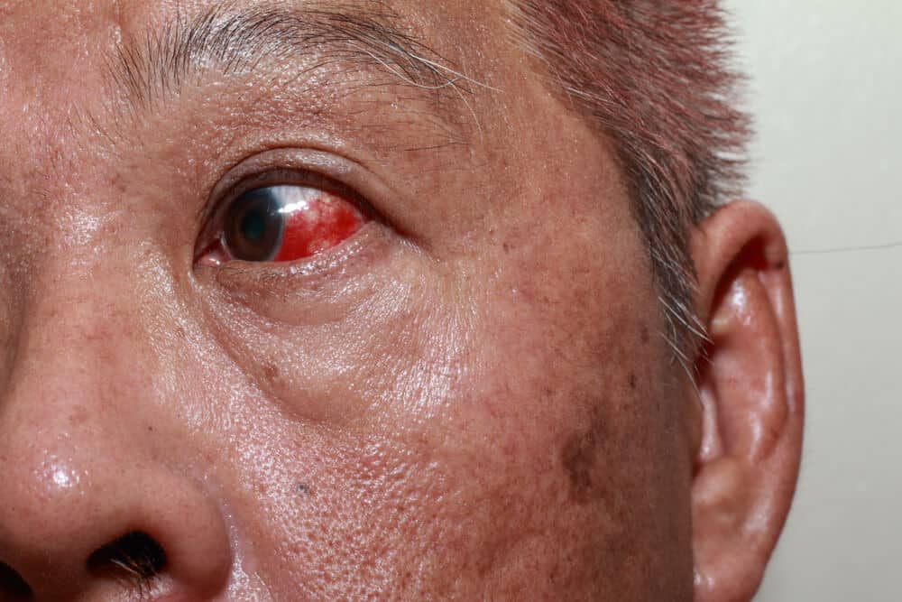 How Art of Optiks Supports Patients with Diabetic Eye Disease