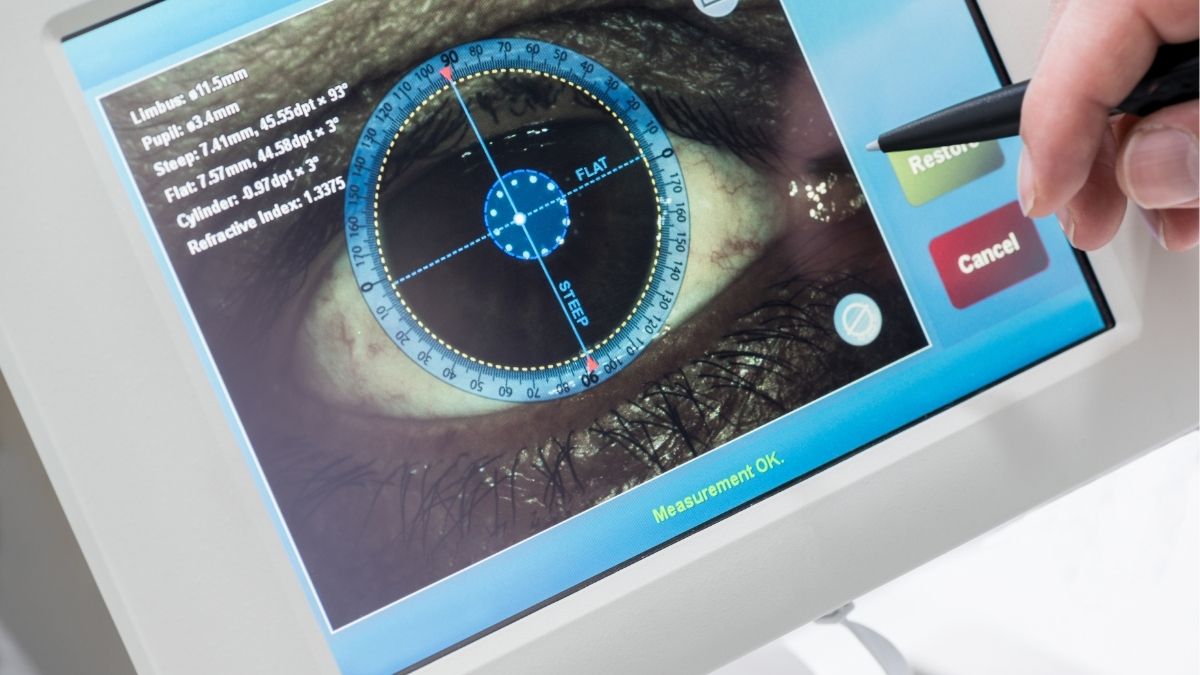 Can You Have LASIK if You Have Thin Corneas?